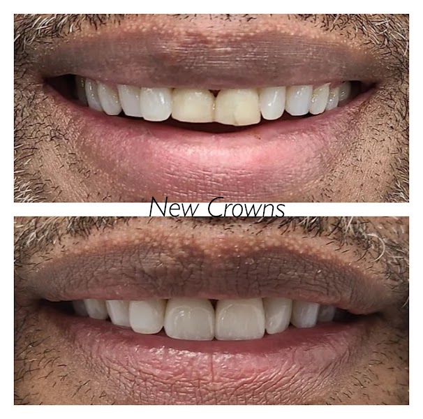 Practice 91aae8a4 - Photo 2