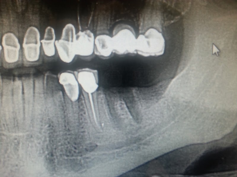 Affordable General Dentistry & Implants